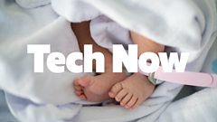 Assisted Birth Innovation Trial Aids UK Hospital Mums