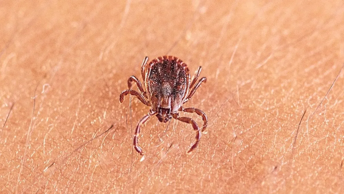 Scientists Identify New Tick Virus Causing Severe Illness