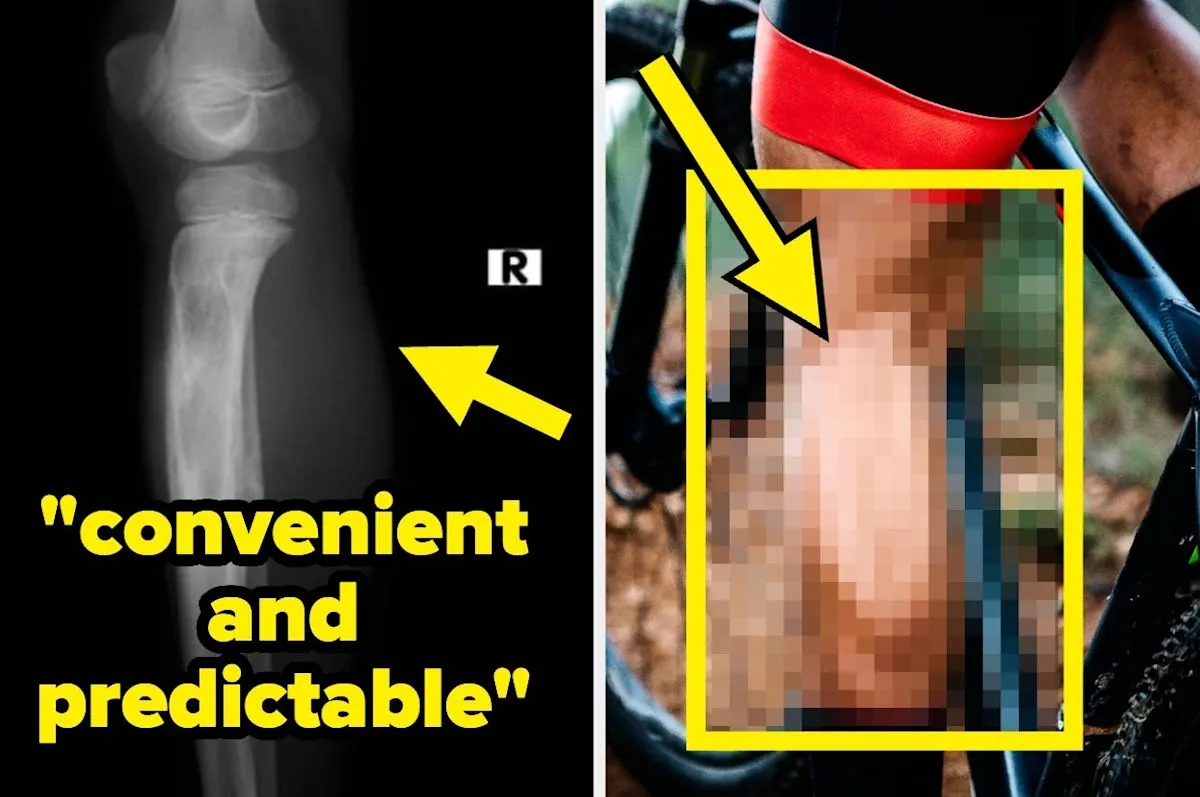 Calf Circumference Emerges as Key Indicator for Longevity