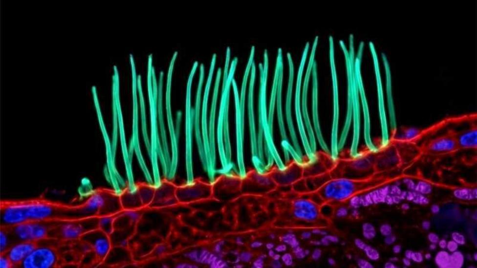 Nikon Photo Contest Backlash: Scientist Defends Image